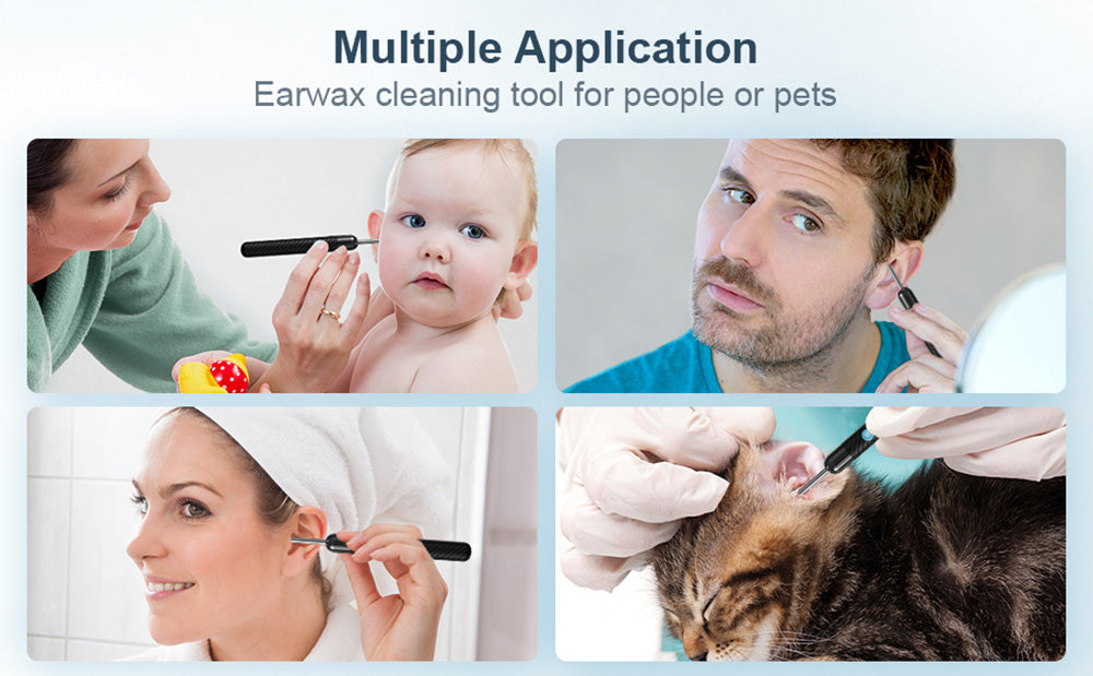 SUNUO X6 Inteligentný vizuálny čistič uší na odstraňovanie ušného mazu, 500W pixelová kamera, silikónový nástavec, 6-osový gyroskop, IP67 vodotesný, WiFi pripojenie - čierna