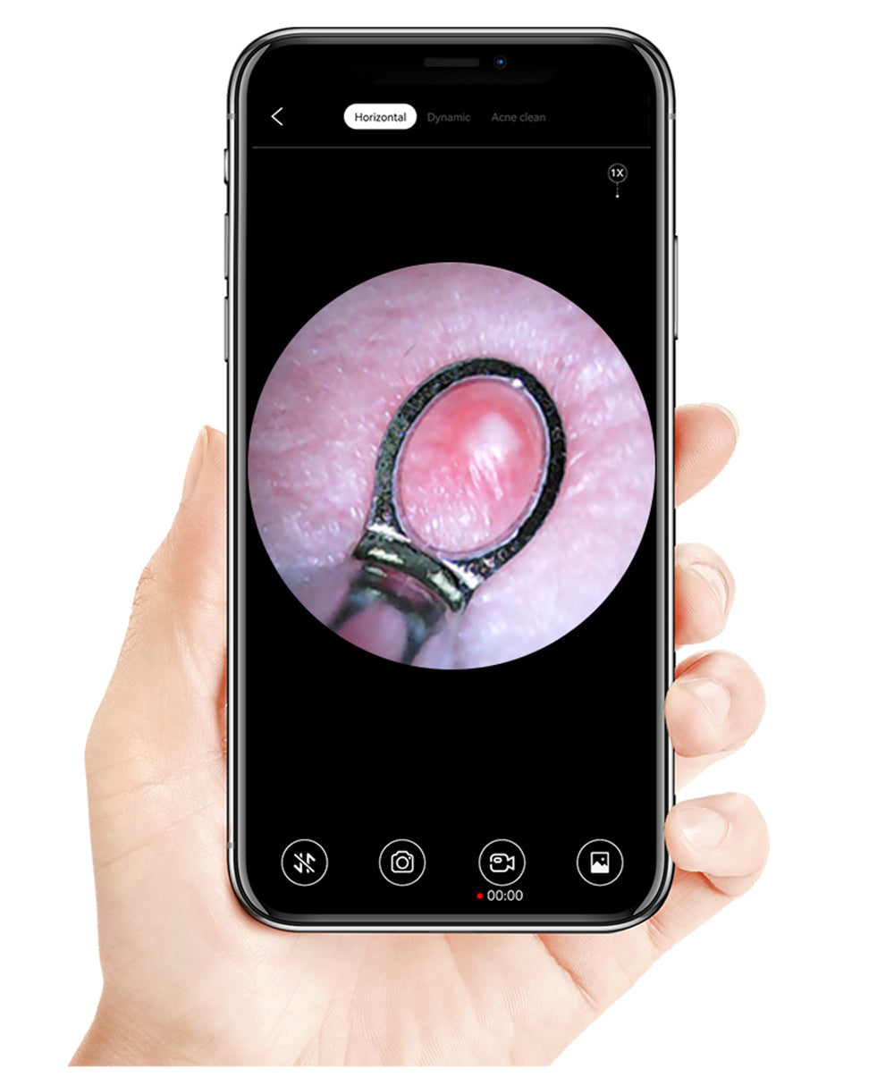 Inteligentný čistič uší SUNUO X8, stláčanie akné, 5MP HD kamera, 6-osový gyroskop, silikónové nástavce, WiFi pripojenie