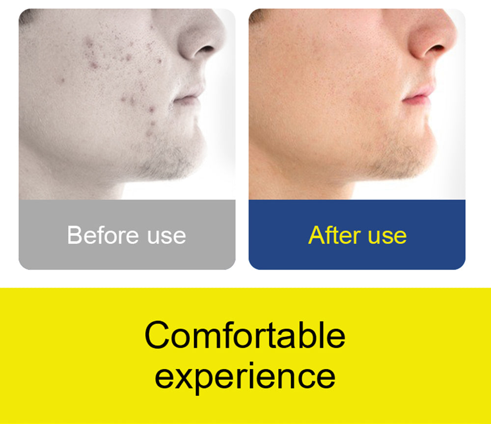 Inteligentný čistič uší SUNUO X8, stláčanie akné, 5MP HD kamera, 6-osový gyroskop, silikónové nástavce, WiFi pripojenie